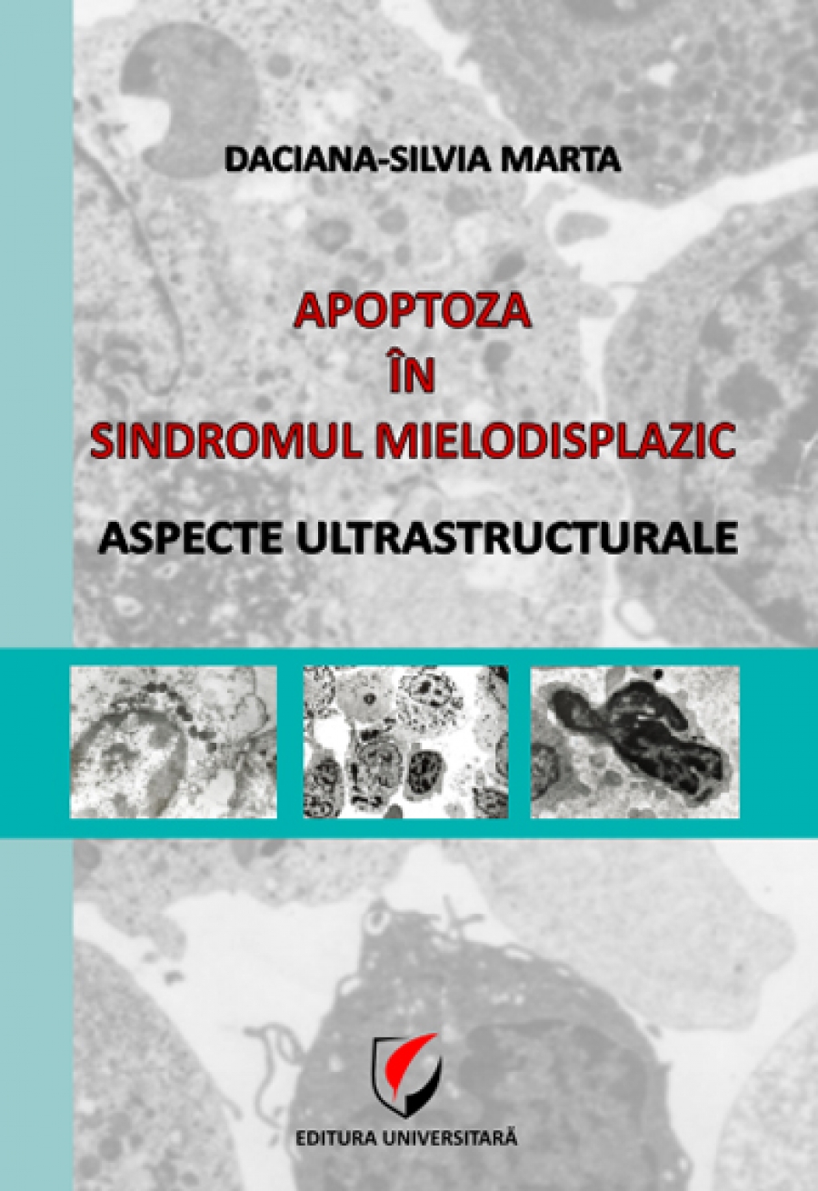 Apoptoza în sindromul mieolodisplazic
